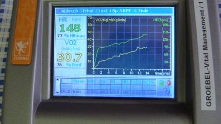 Display eines Fahrradergometers mit Herzfrequenzkurve
